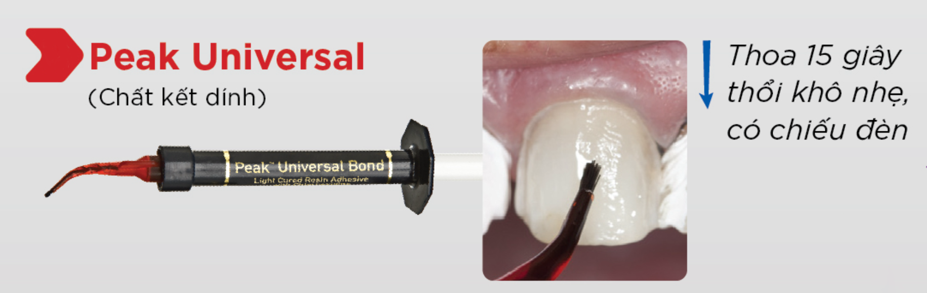 Các bước sử dụng bộ vật liệu gắn mặt dán sứ veneer của hãng Ultradent🌱NHA KHOA MALL🌱